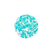GMS Stain Kit (Modified Gomori)